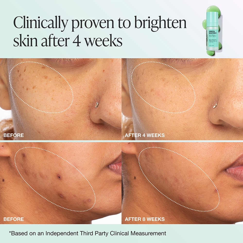 Innbeauty Project Green Machine serum full size C-vitamin olje