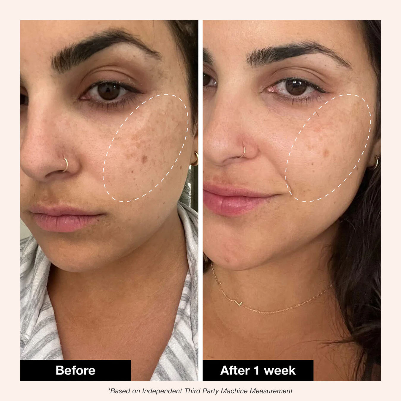 Innbeauty Project Retinol Remix 1% retinolkrem