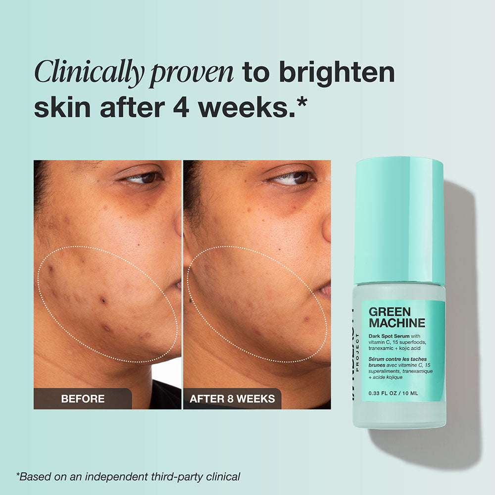 Innbeauty Project Brightening Essentials hudpleiesett vitamin C