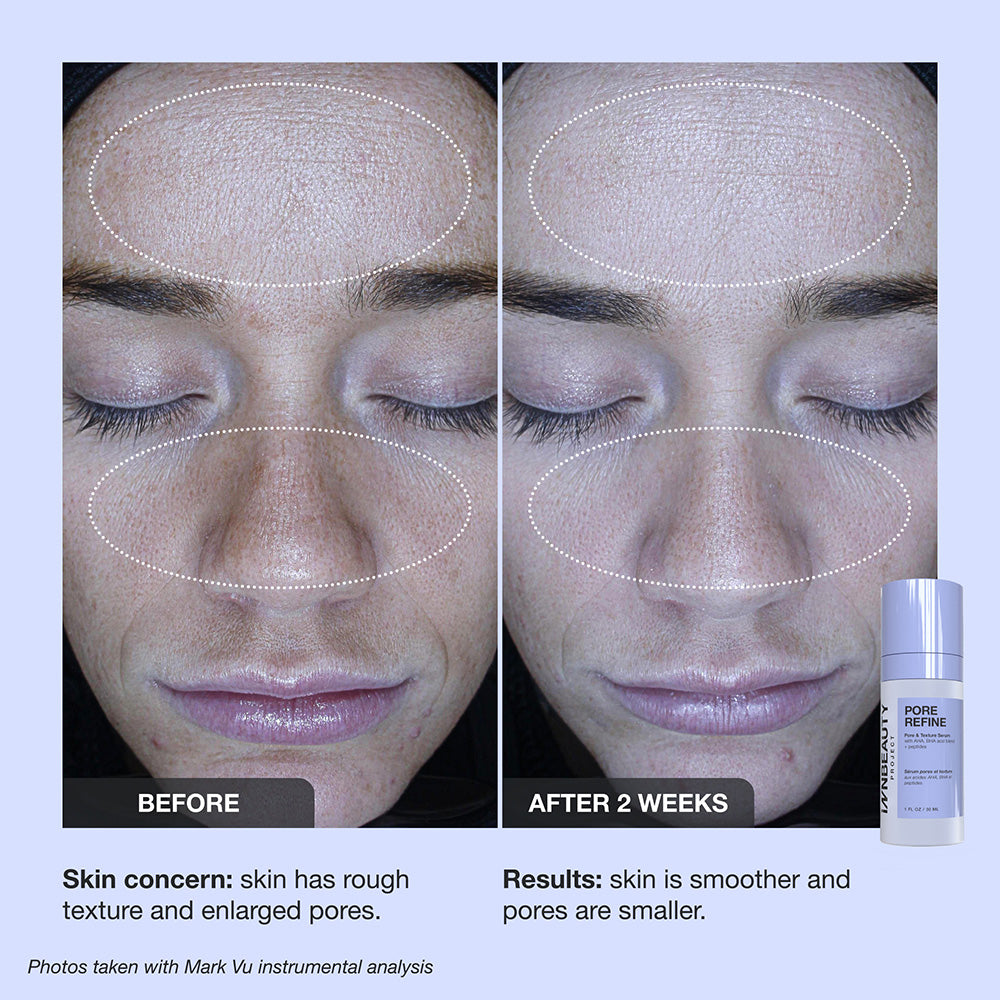Innbeauty Project Pore Refine serum full size grove porer