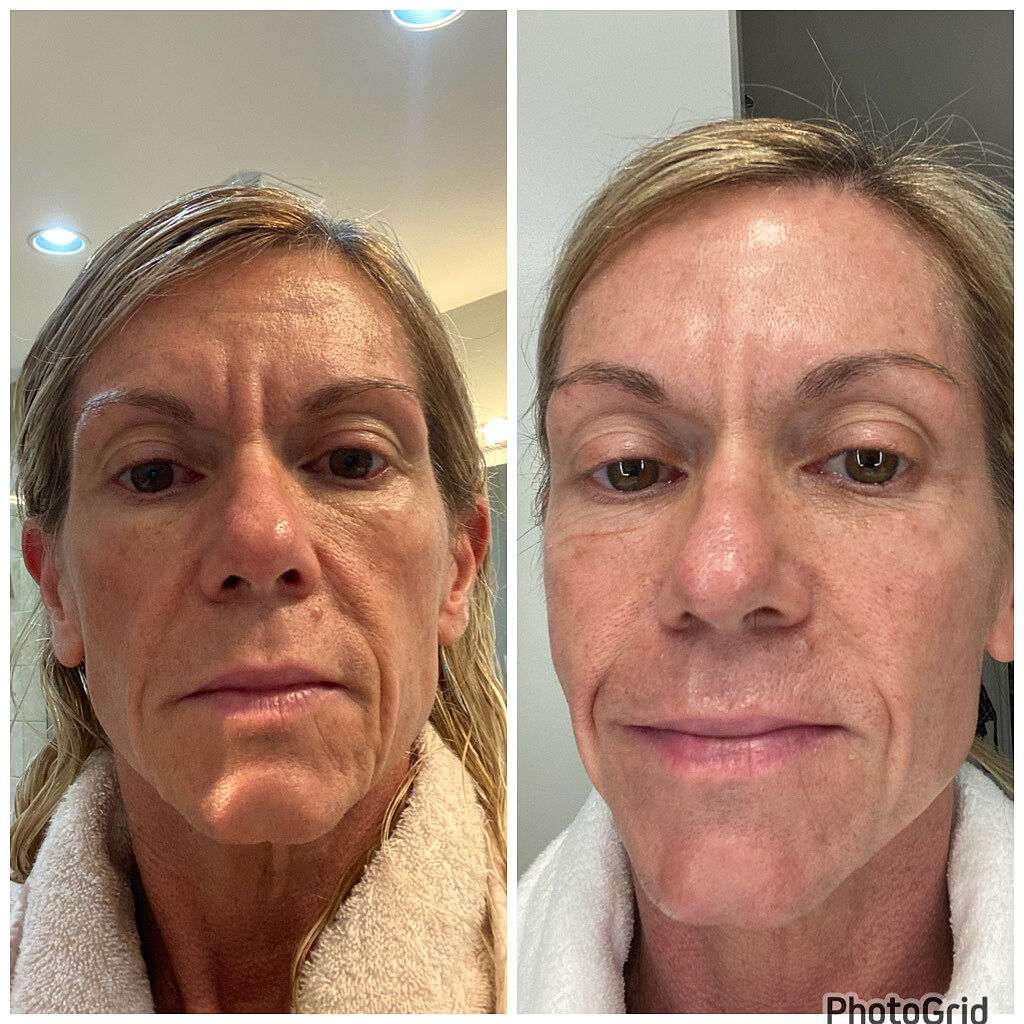 Innbeauty Project Bright & Tight refillsett serum