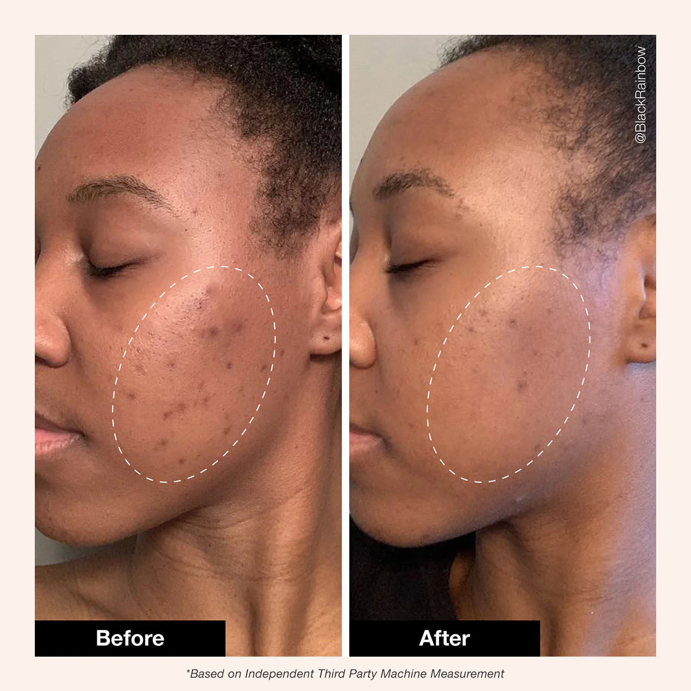 Innbeauty Project Retinol Remix 1% retinolkrem