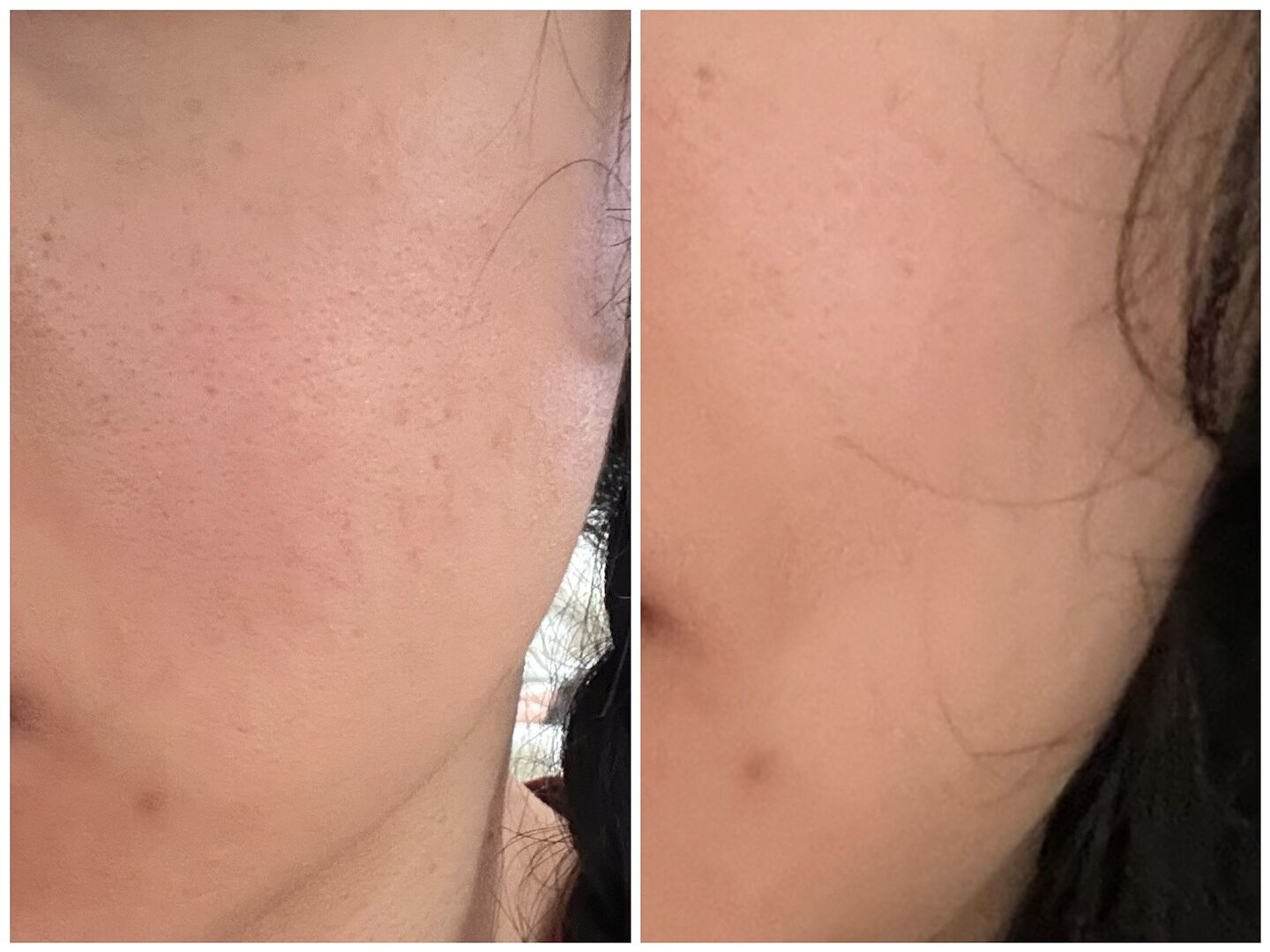 Innbeauty Project 10+10 Daily Moisturizer fuktighetskrem C-vitamin