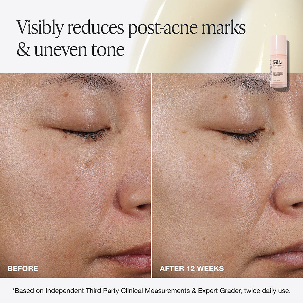 Innbeauty Project Pro C serum full size mot mørke flekker