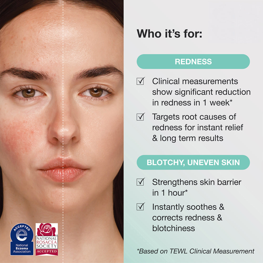 Innbeauty Project Calm The Red Down serum mot rødhet