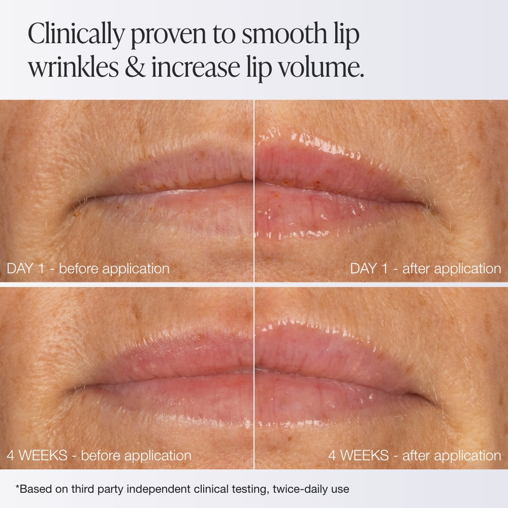 Innbeauty Project Extreme Lip leppebehandling peptid bær-vanilje