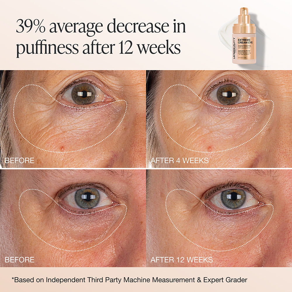 Innbeauty Project Extreme Cream Eye øyekrem full size parfymefri
