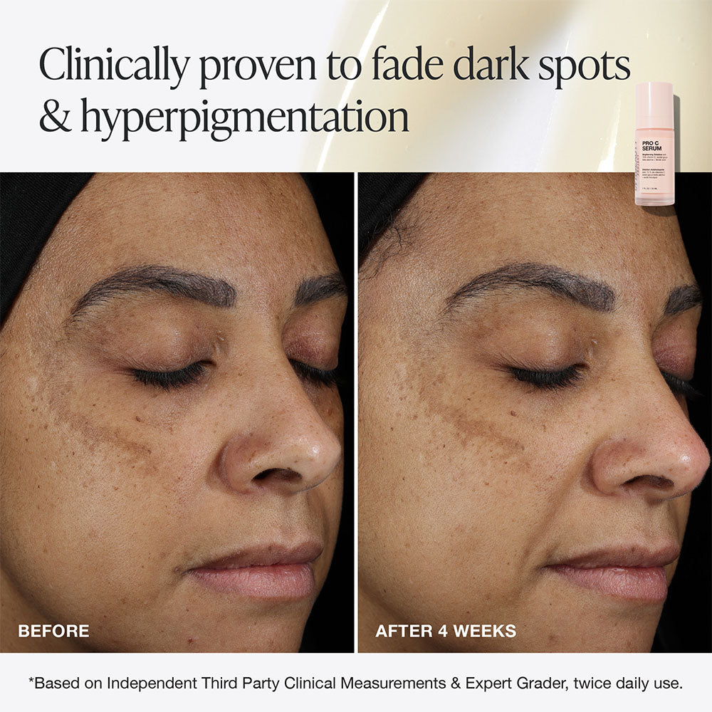 Innbeauty Project Pro C serum full size mot mørke flekker