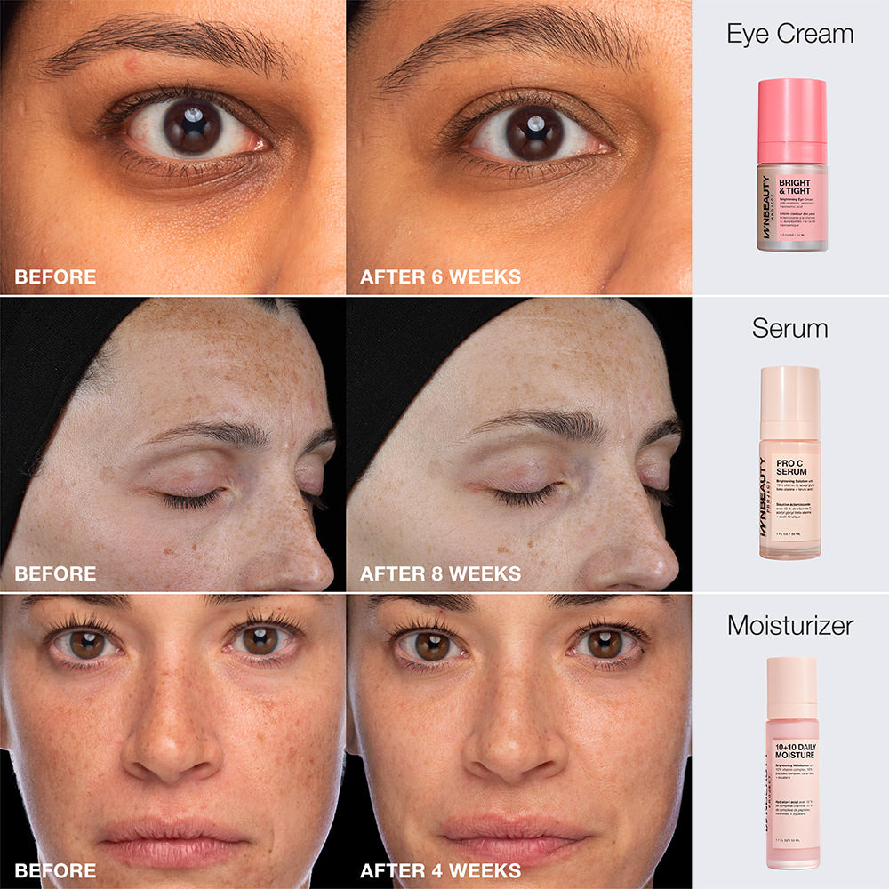 Innbeauty Project Brightening Trio serumsett tranexamsyre