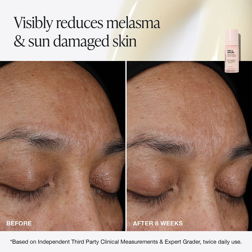 Innbeauty Project Pro C serum full size mot mørke flekker