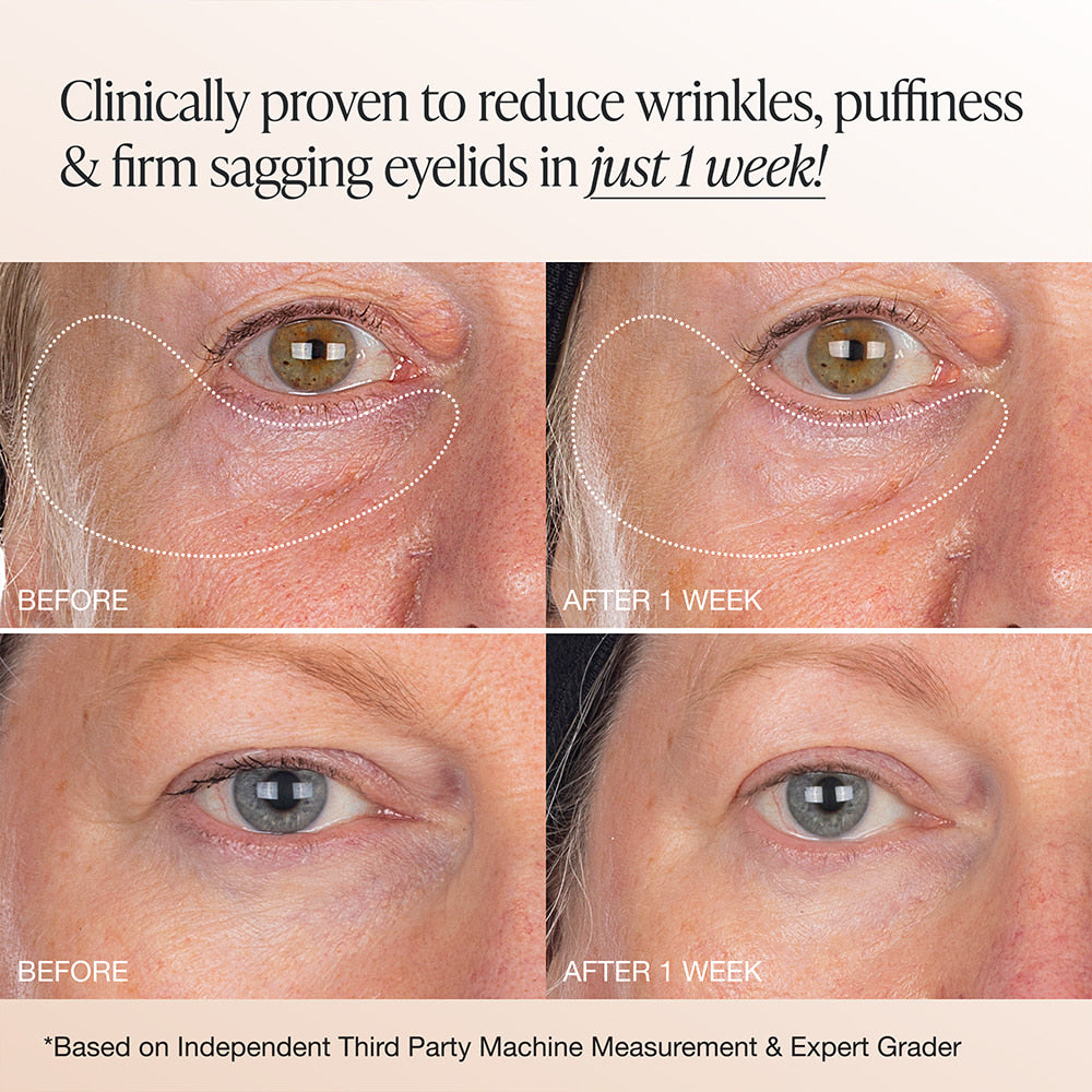 Innbeauty Project Extreme Cream Eye øyekrem full size parfymefri