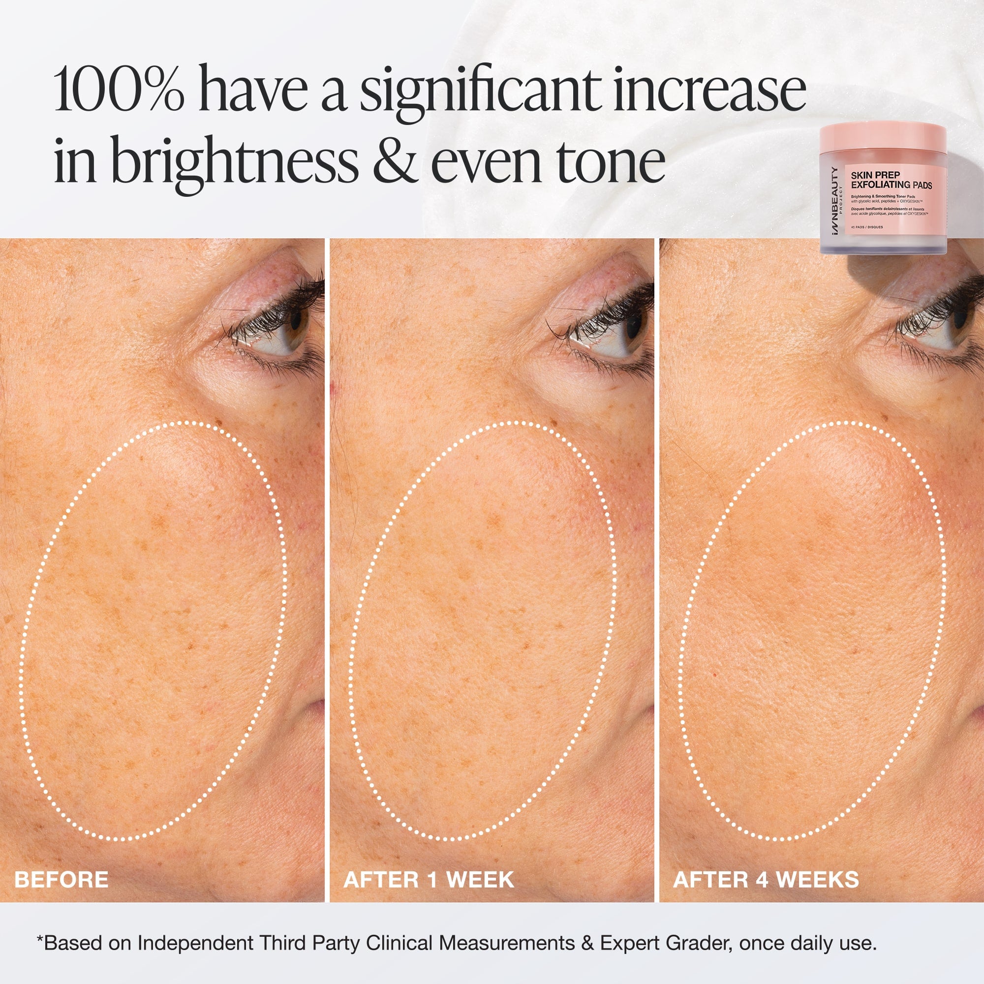 Innbeauty Project Skin Prep eksfoliering pads 45 stk glød