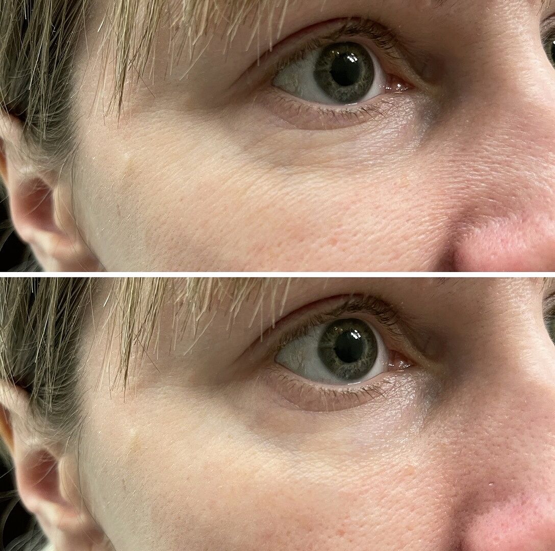 Innbeauty Project Extreme Cream Eye øyekrem full size parfymefri