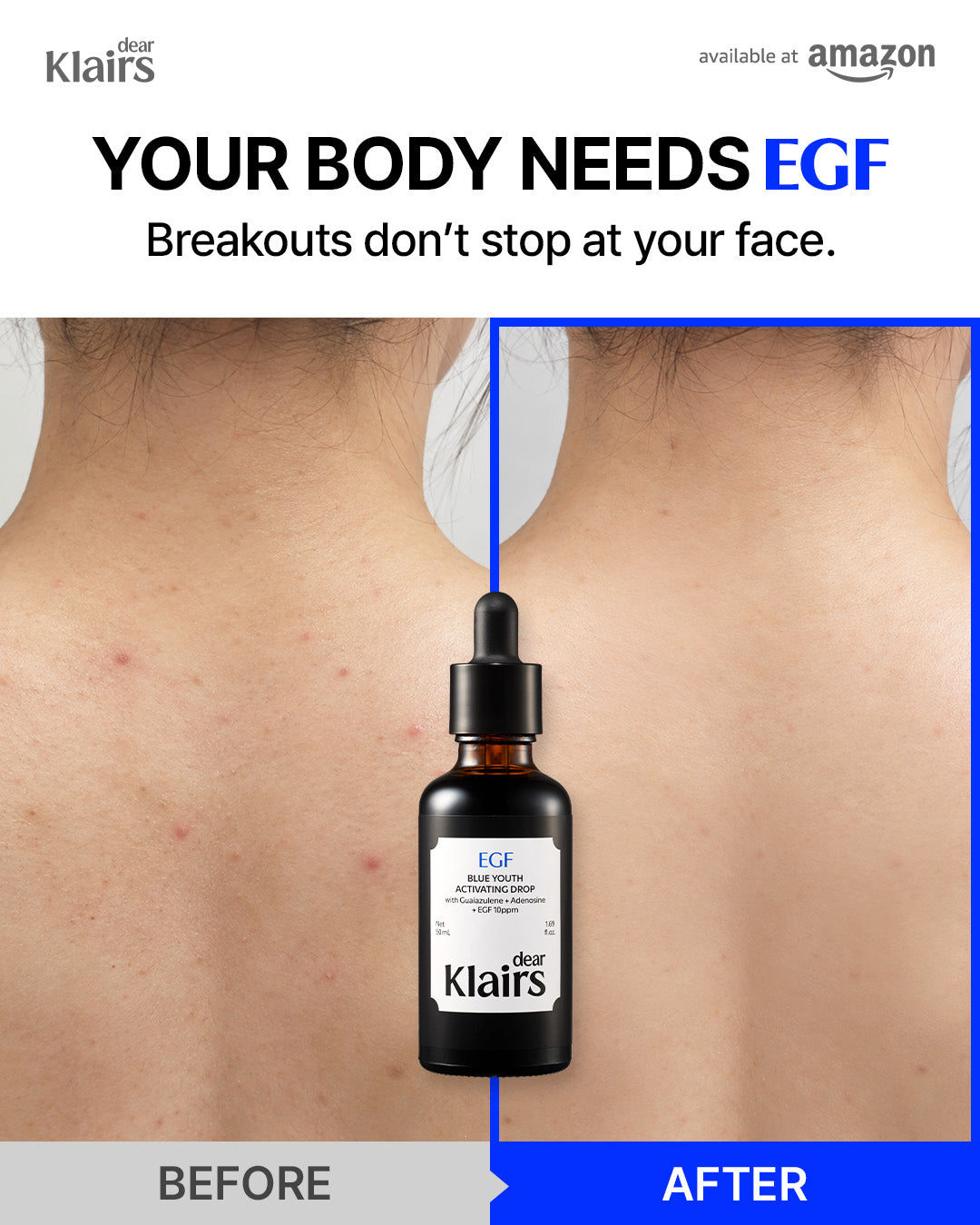Dear Klairs Blue Youth Activating Drop EGF-serum beroligende