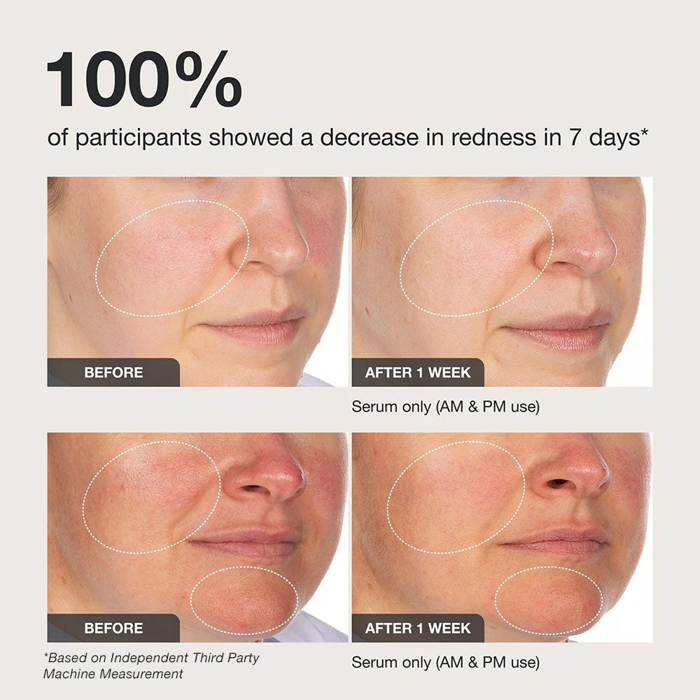 Innbeauty Project Calm The Red Down serum mot rødhet