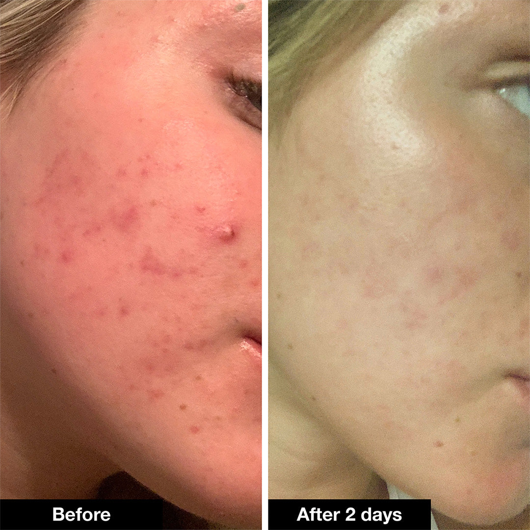 Innbeauty Project Drying Paste kvisekrem natt