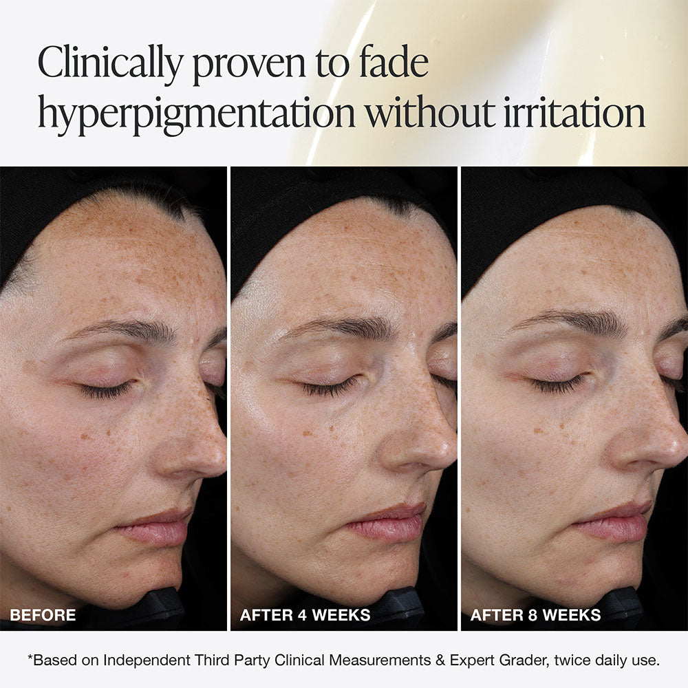 Innbeauty Project Pro C serum full size mot mørke flekker
