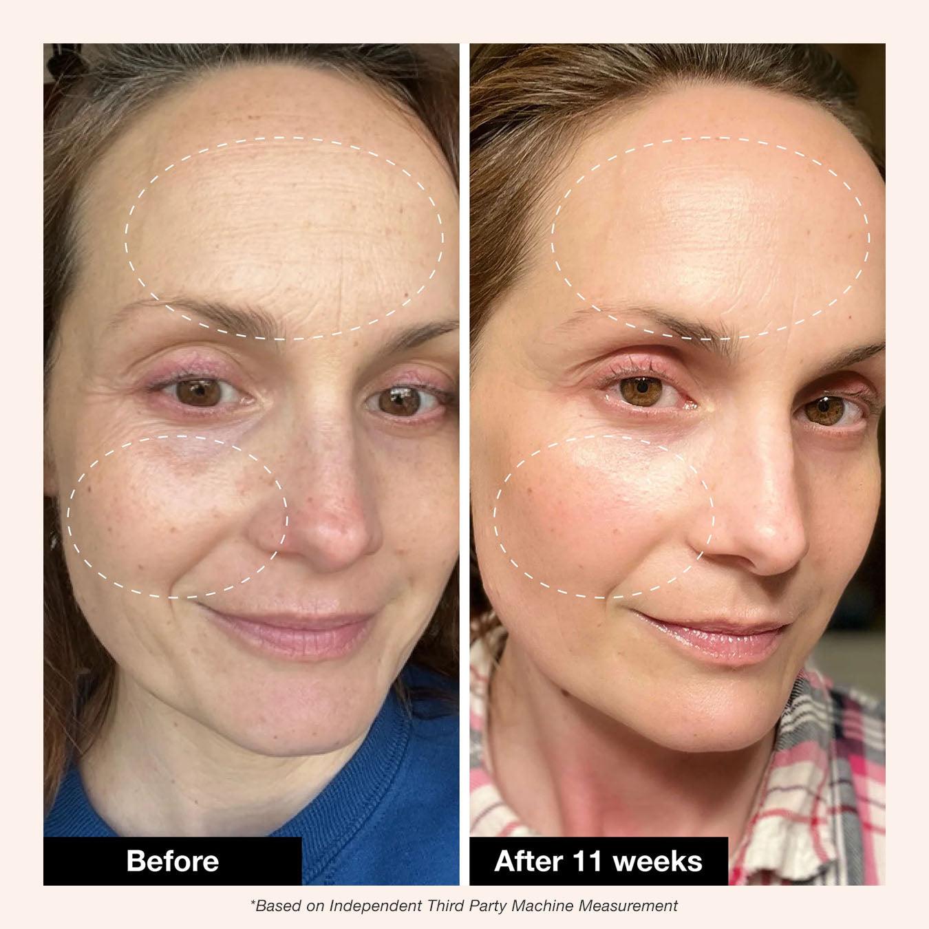 Innbeauty Project Retinol Remix 1% retinolkrem