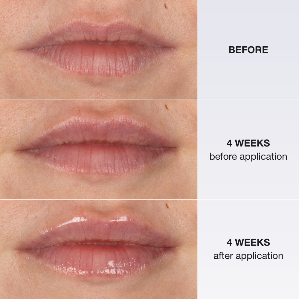 Innbeauty Project Extreme Lip leppebehandling peptid bær-vanilje