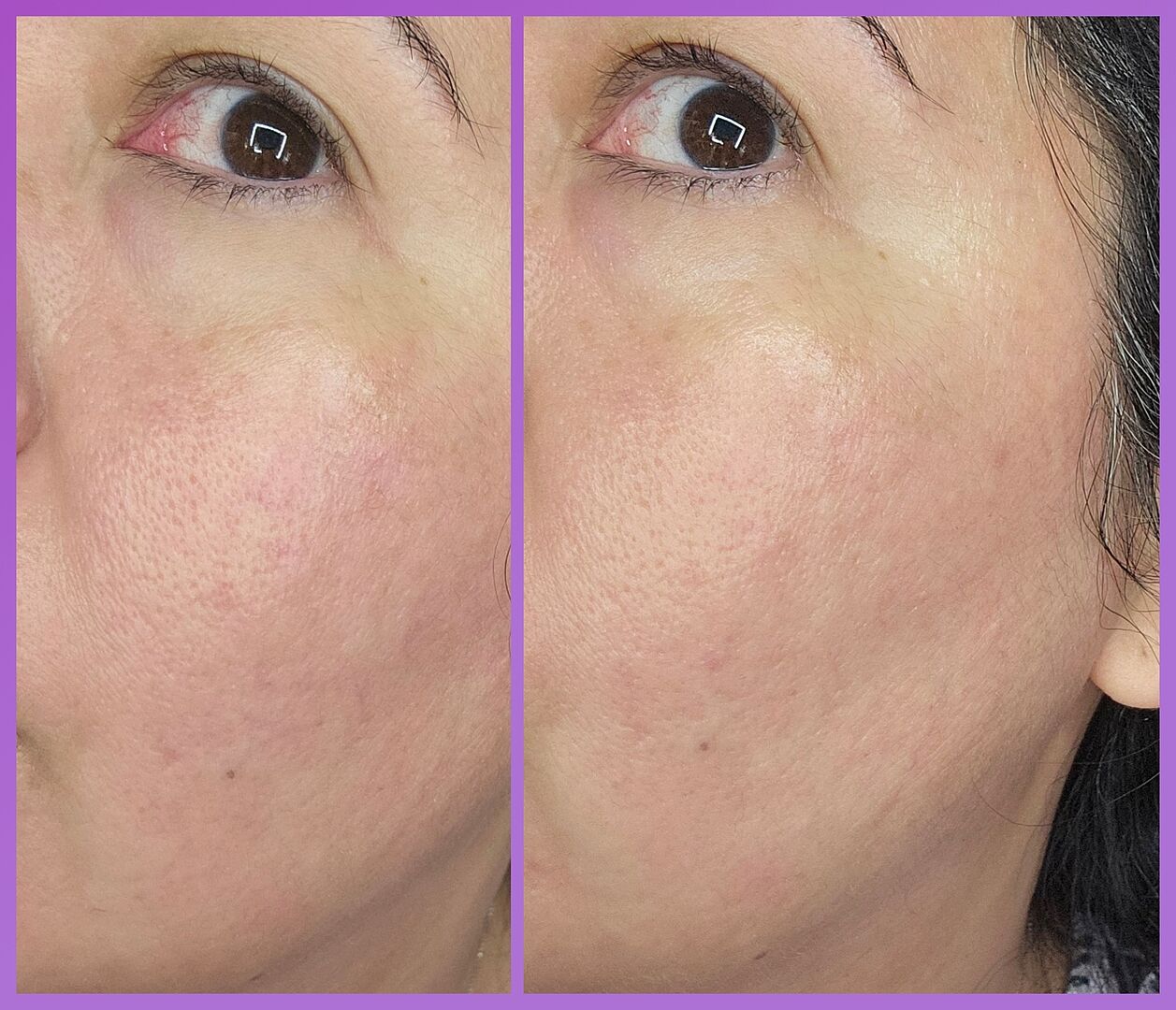 Innbeauty Project Brightening Trio serumsett tranexamsyre